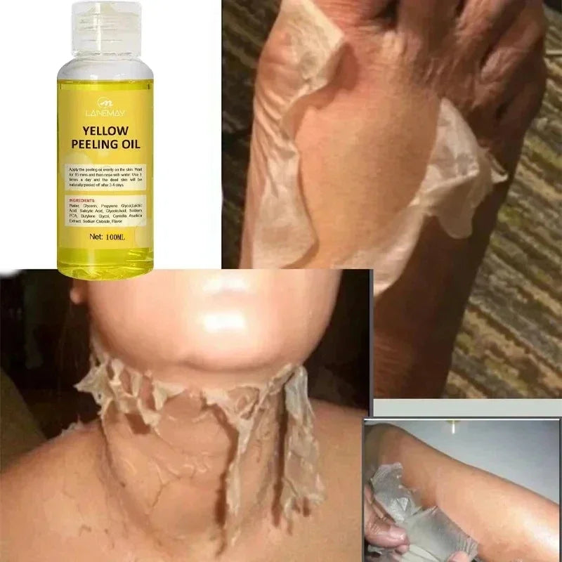 Organic Yellow Peeling Oil – Fast Whitening Exfoliant
