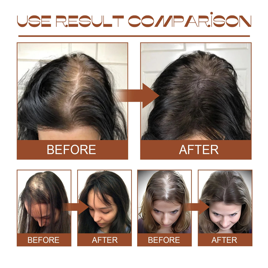 100% Pure Organic Batana Oil Hair Mask
