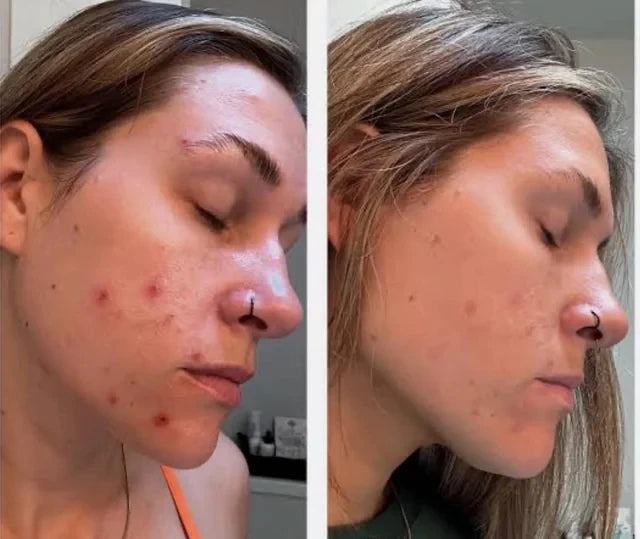 Beef Tallow Face Cream – Moisturizing & Firming