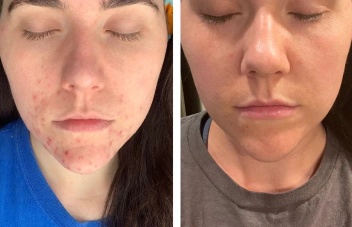 Beef Tallow Face Cream – Moisturizing & Firming