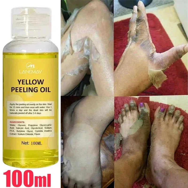Organic Yellow Peeling Oil – Fast Whitening Exfoliant