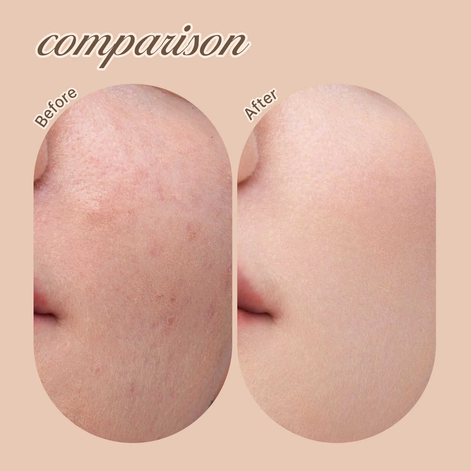 6-Color Liquid Concealer Stick – Full Coverage & Matte Finish Foundation