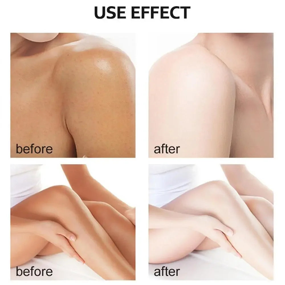 Organic Yellow Peeling Oil – Fast Whitening Exfoliant