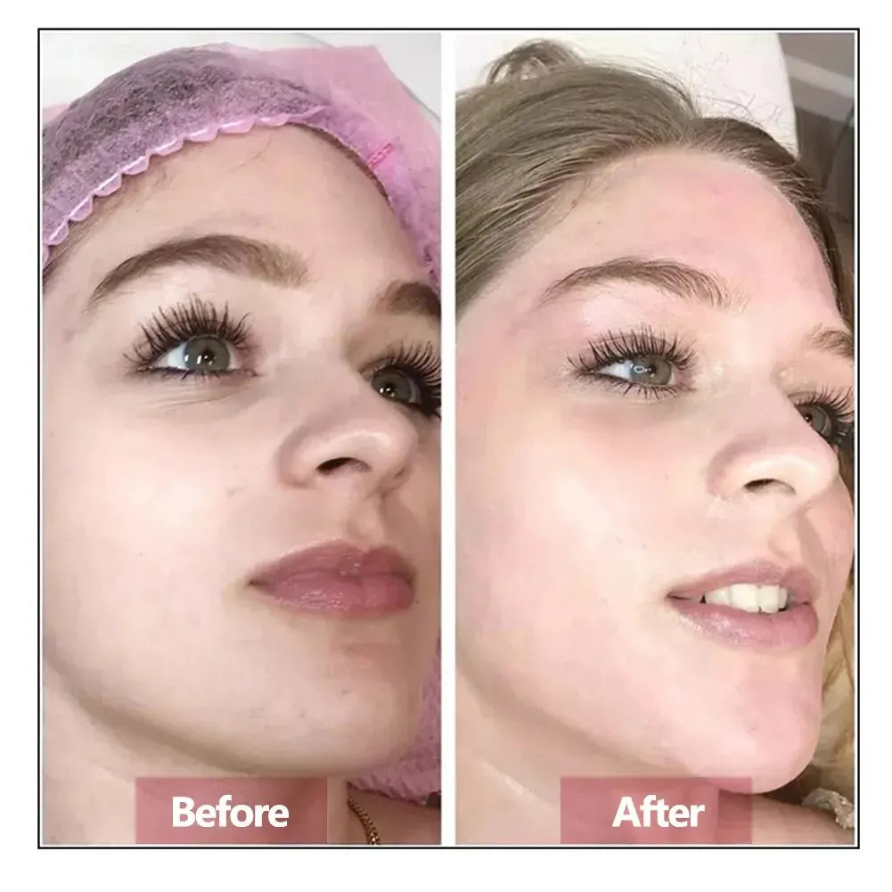 Hyaluronic Acid Face Serum – Hydrating & Anti-Aging