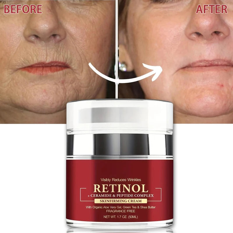 Instant Retinol Firming Cream – Anti-Aging & Moisturizing