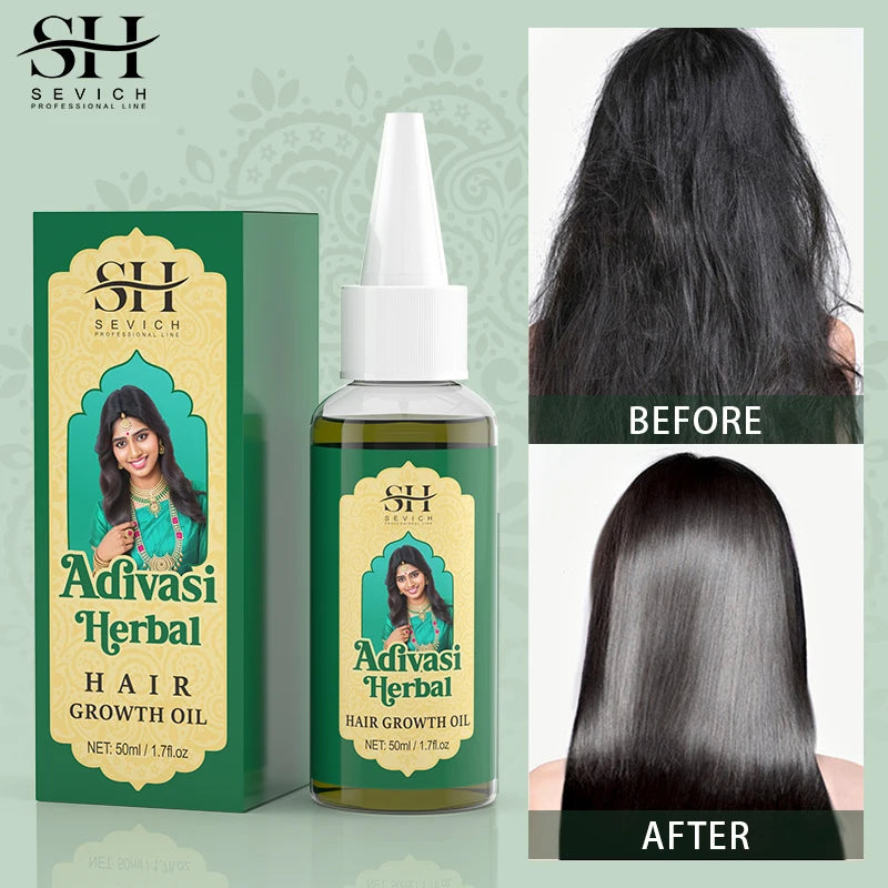 Ayurvedic Adivasi Hair Growth Oil – Organic & Fast Regrowth