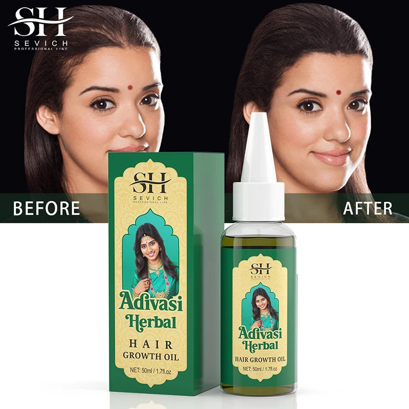 Ayurvedic Adivasi Hair Growth Oil – Organic & Fast Regrowth