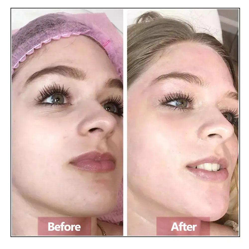 Hyaluronic Acid Face Serum – Hydrating & Anti-Aging