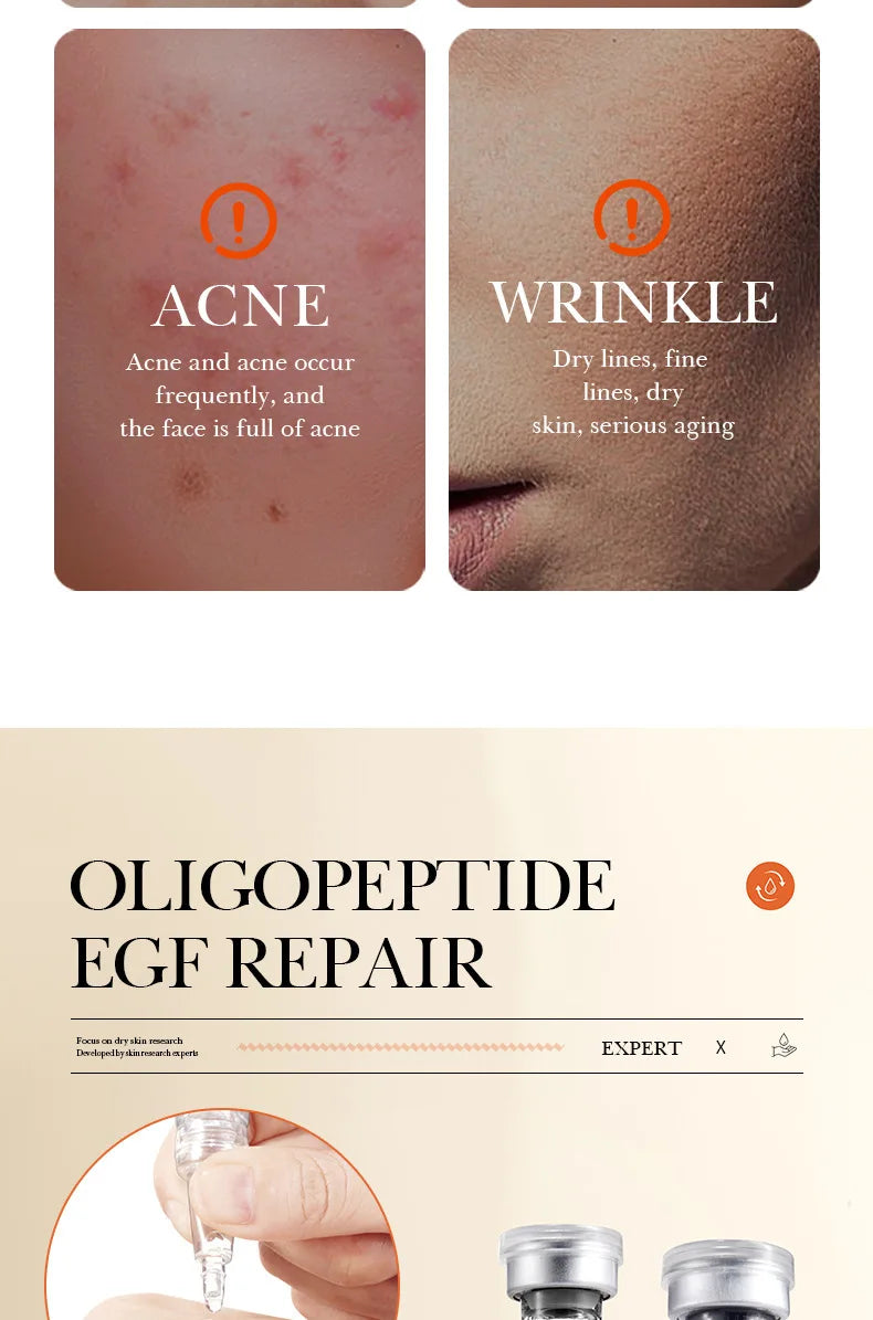 Microneedling Serum Set – Yeast Peptide Essence