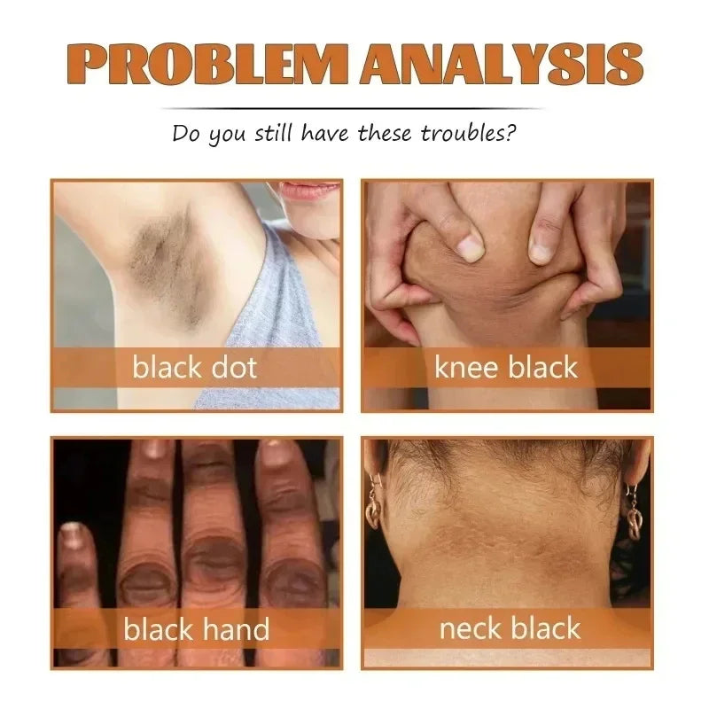 Organic Yellow Peeling Oil – Fast Whitening Exfoliant