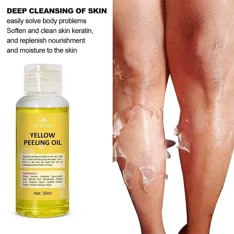 Organic Yellow Peeling Oil – Fast Whitening Exfoliant